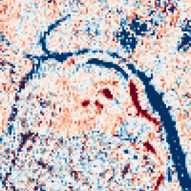 MBMP methane signal for Deonar on 6 January 2025: red where shortwave-infrared band 12 is darker than in clean passes